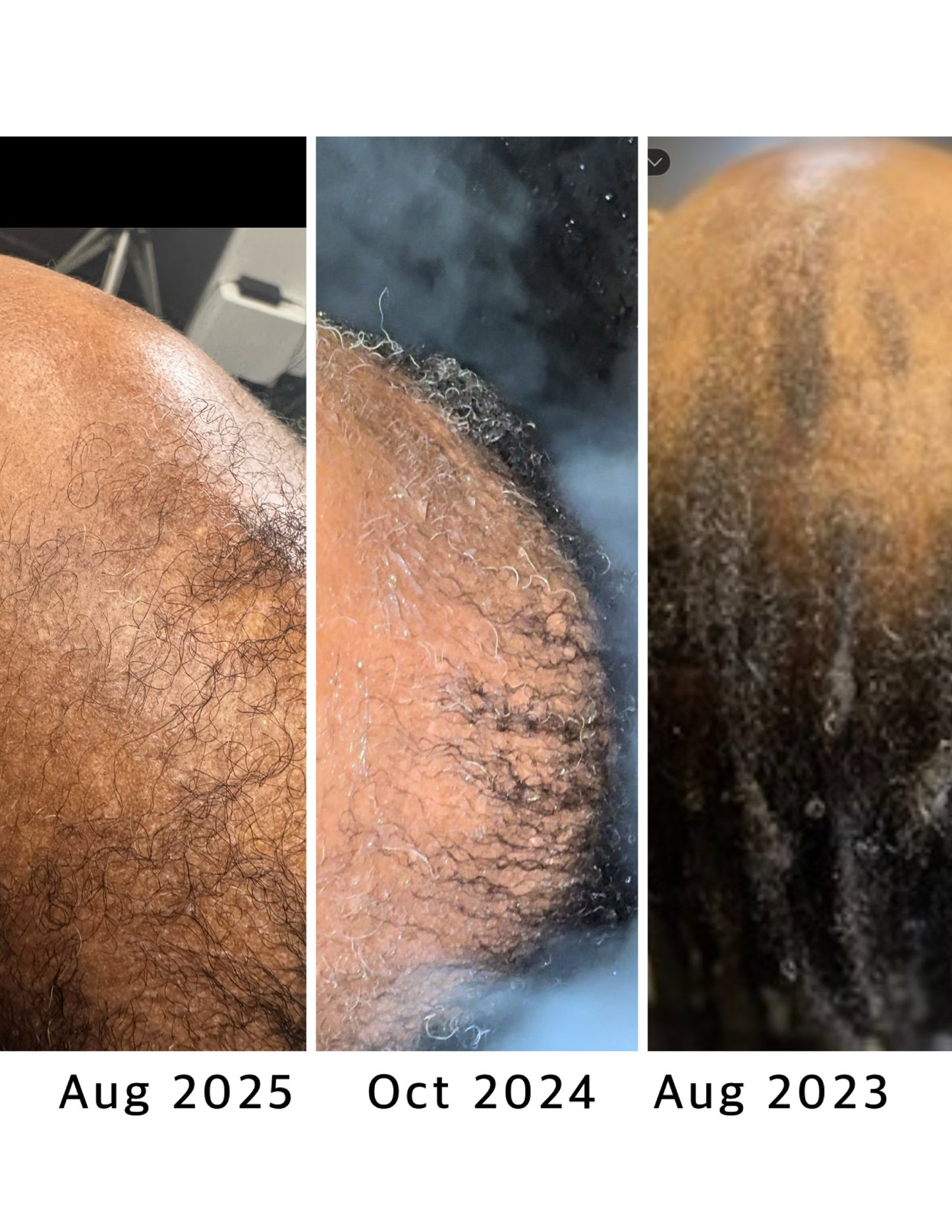 SVN Hair Growth Serum