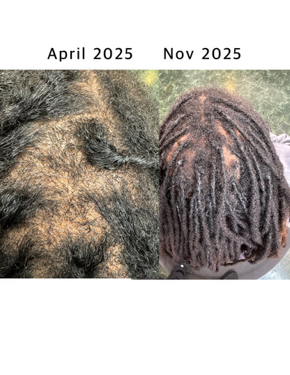 SVN Hair Growth Serum