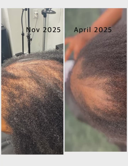 SVN Hair Growth Serum