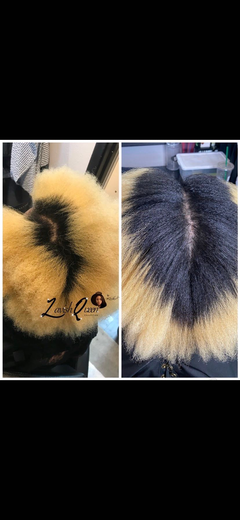 SVN Hair Growth Serum