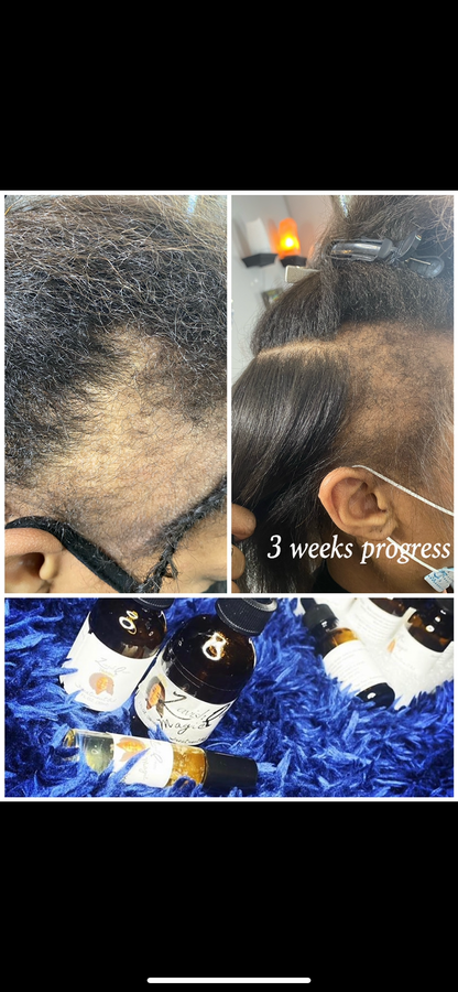 SVN Hair Growth Serum