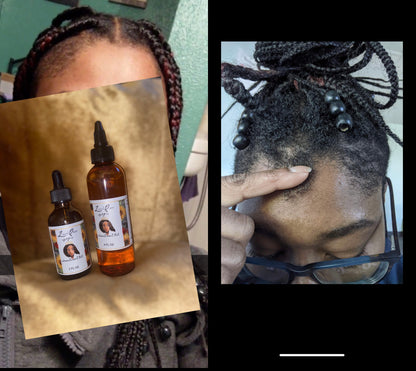 SVN Hair Growth Serum