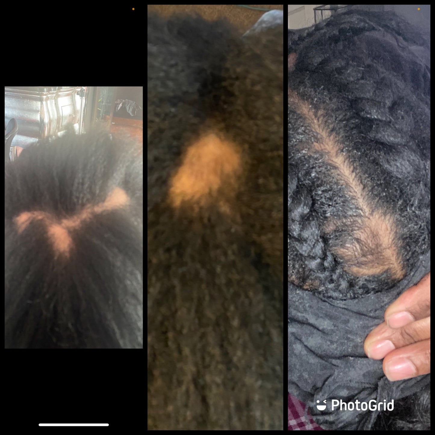 SVN Hair Growth Serum